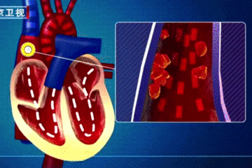 心脏血液循环动图图片