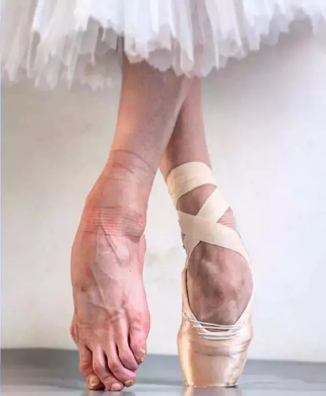 舞蹈生的脚变形图片