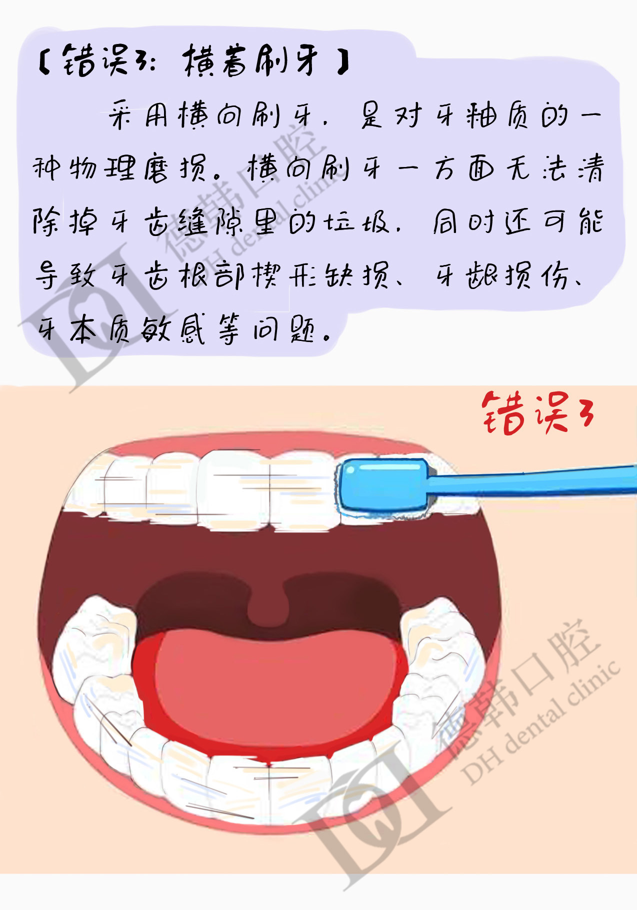 刷牙最常犯的六個錯誤,看看自己佔了幾個!