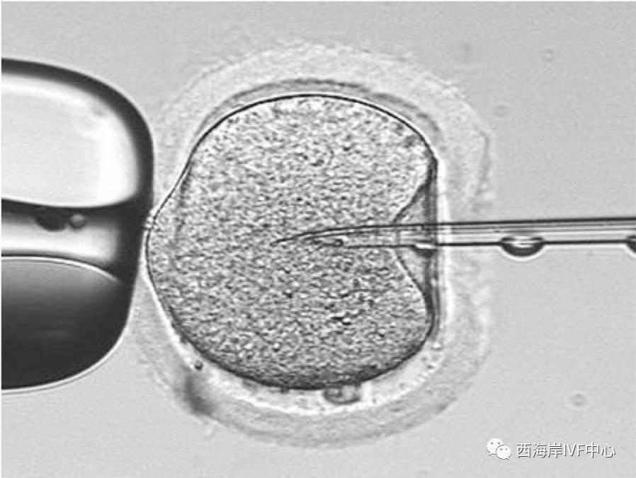 美国试管婴儿之显微镜下的生命起源