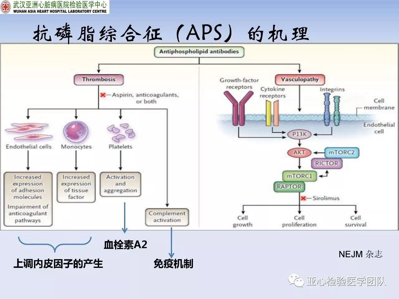 抗磷脂综合征与抗磷脂抗体