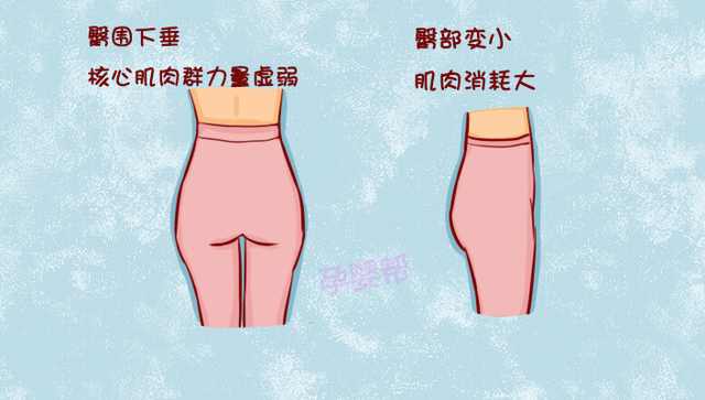 女性的4种臀部透漏健康状况,你知道么?