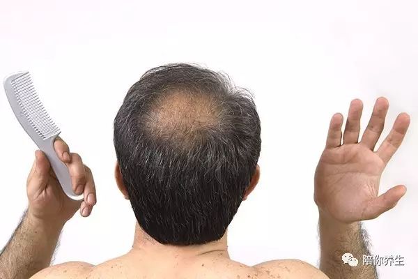 为什么男人更容易发生秃顶现象可能是因为这些原因