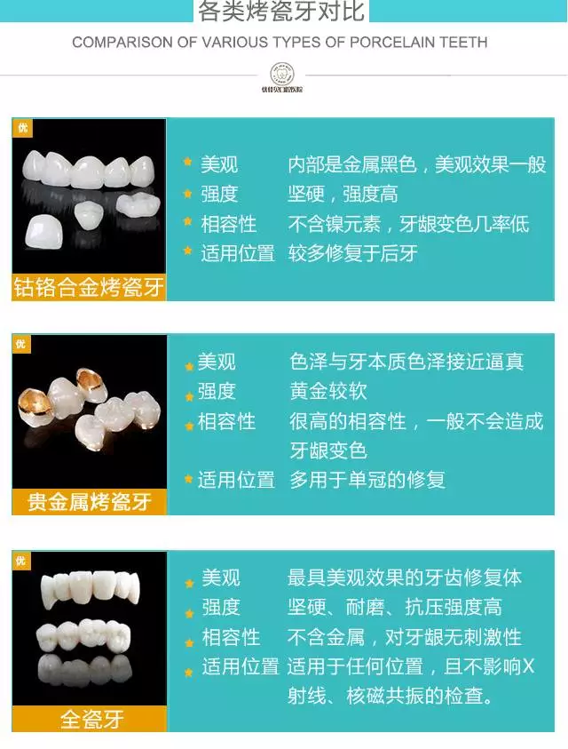 牙冠的种类及价格图片