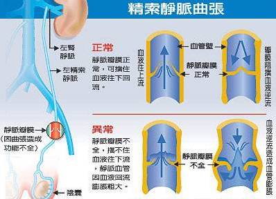 精索静脉走行图片