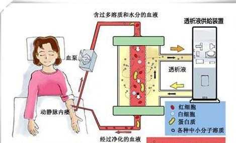 透析疼吗(透析 疼吗)