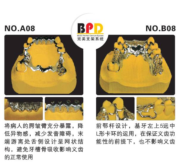 不合理设计合理的设计合理放置颌支托位置减少对基牙的损伤我们把支点