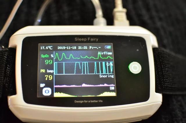 一款优秀的国产便携式睡眠监测仪:万脉睡眠监测