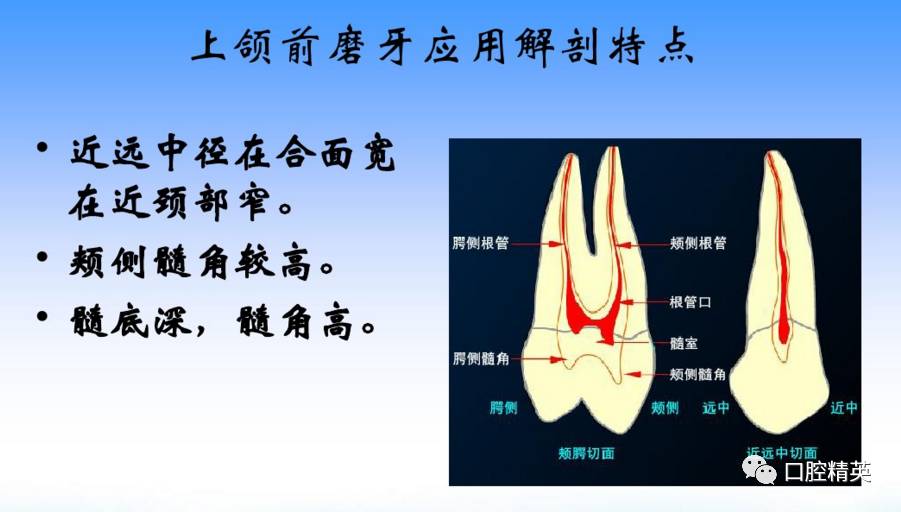 詳解各牙位的開髓整理版