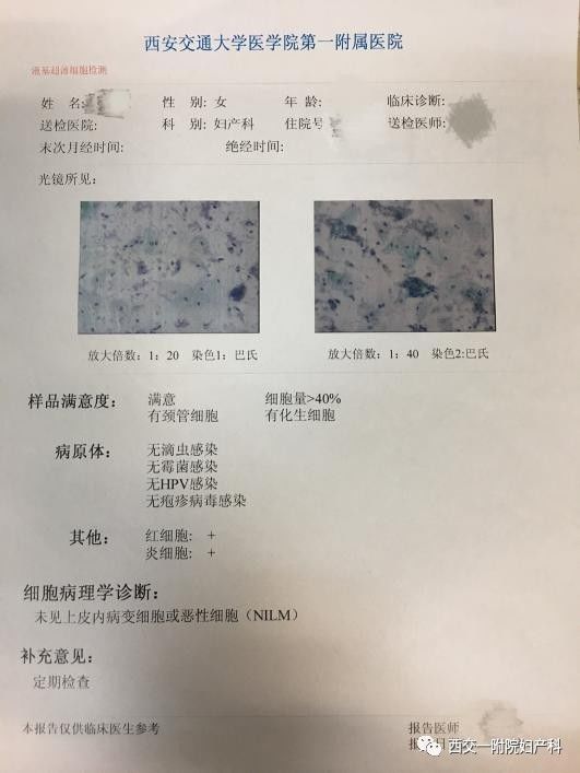 这时tct是检测不到的,所以临床上通常同时做tct和hpv检测,以确定是否