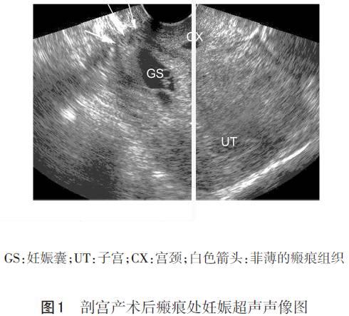 梭形子宫图片图片