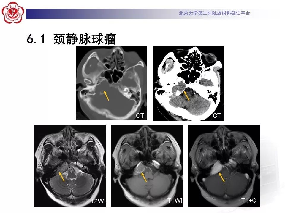 北醫三院放射科病例246神經五官