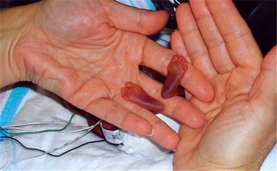 怀孕54天的宝宝图片图片