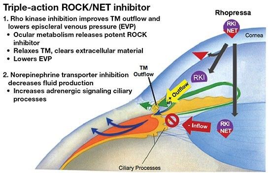 rhopressa的作用机制(图片来源:eyeworld magazine)基于rhopressa的