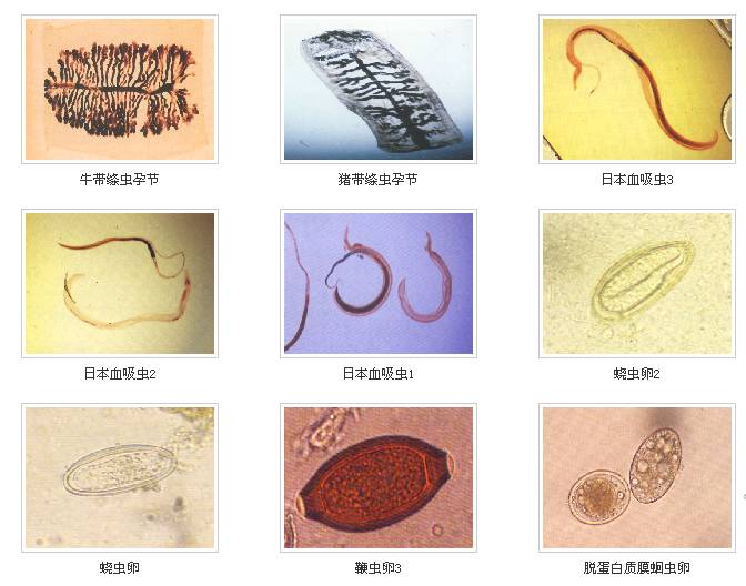 肠道寄生虫种类图片