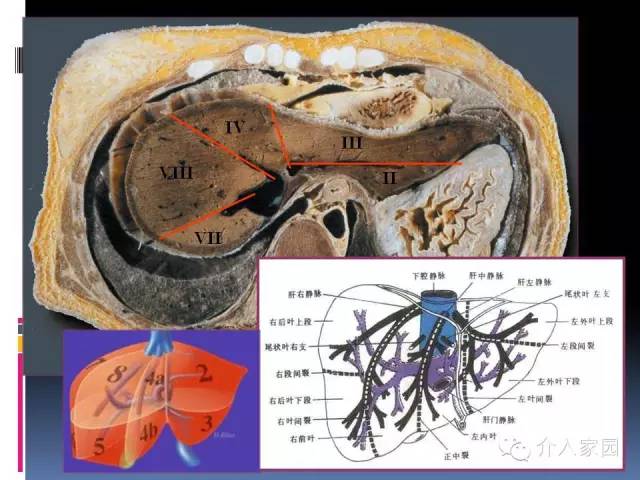 典藏肝臟分段及血管詳細辨識
