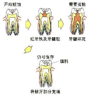牙髓炎睡觉姿势图片