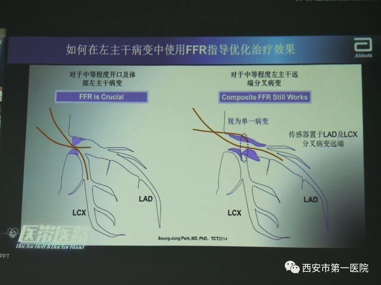 西安市第一醫院分會場我是大醫聲-左主幹專場線上病例討論會圓滿成功