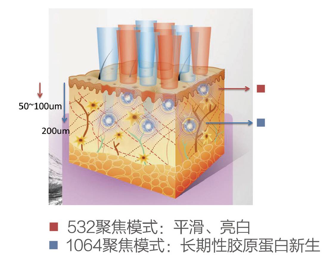 祛斑界的法拉利丨第Ⅱ代超皮秒即将登陆焕誉医美,范爷都为之倾心