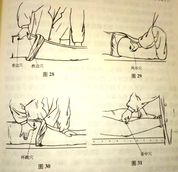 中医正骨手法治疗腰椎间盘突出