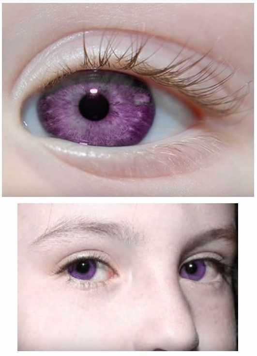 紫罗兰色瞳孔图片