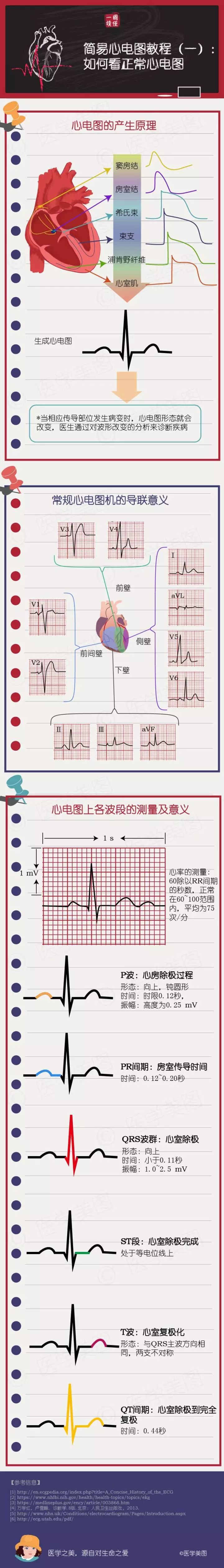 看心电图的简易看法图片