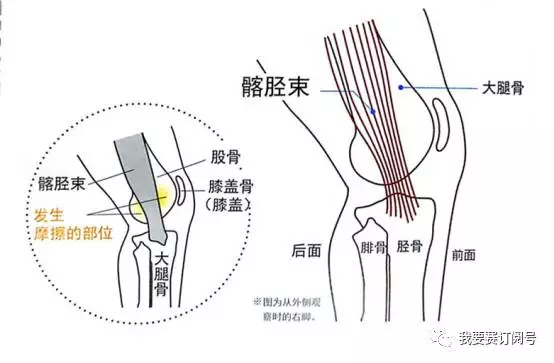 髂胫束与大腿骨下端的骨骼凸出部分(外上髁)会互相摩擦,改变前后位置