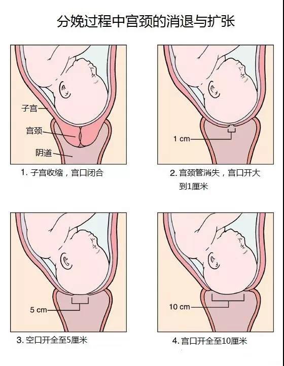 顺产全过程图解图片