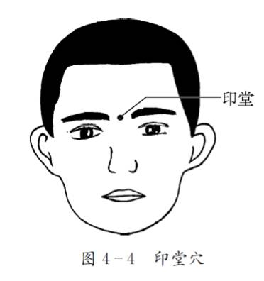 印堂:在額部,兩眉頭中間(圖4-4)四神聰:在頭頂部,當百會穴前後左右各1