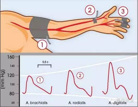测血压肱动脉位置图图片