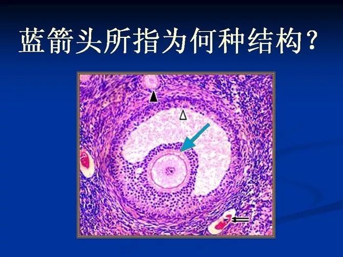 照片名稱:59卵丘照片名稱:58次級卵泡照片名稱:57原始卵泡 初級卵泡