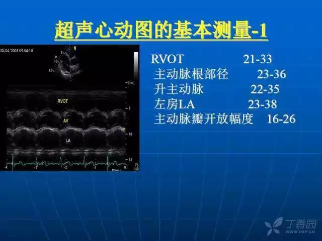 心内科基本功超声心动图标准切面及正常值