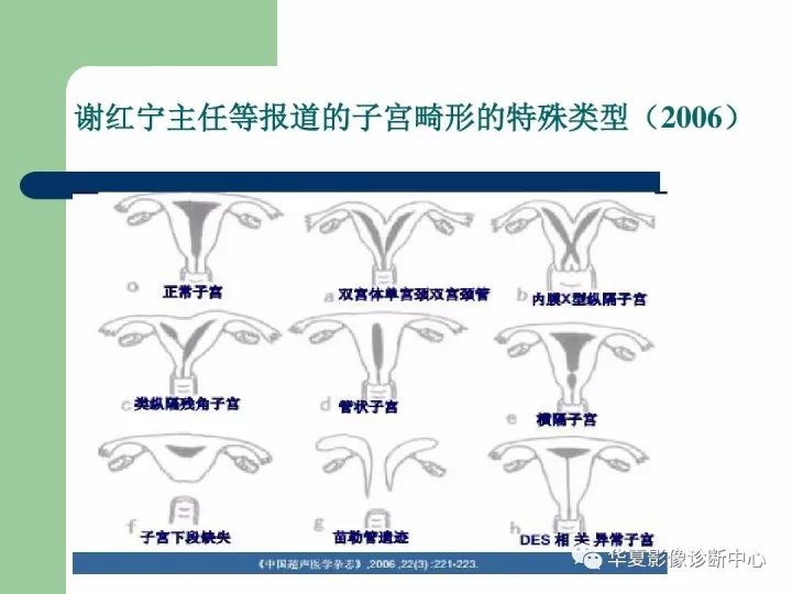 子宫发育畸形这样分类的赶紧收藏了