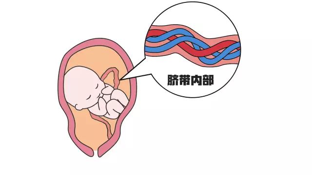 脐带绕颈w型图片欣赏图片