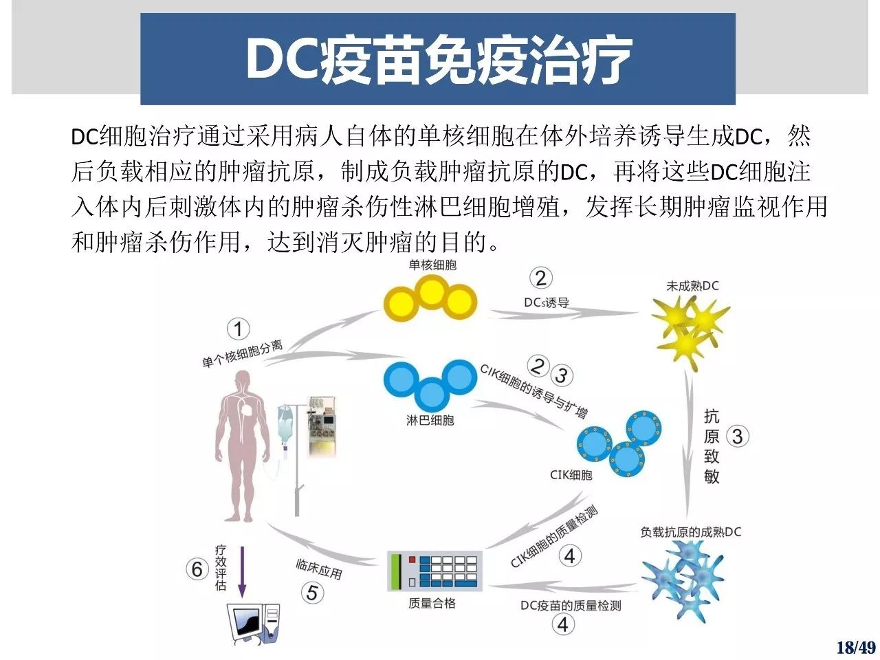 研究肿瘤细胞来源外泌体联合糖脂质致敏树突状细胞疫苗