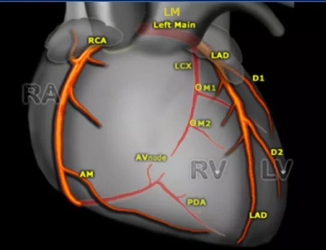 冠状动脉彩图图片