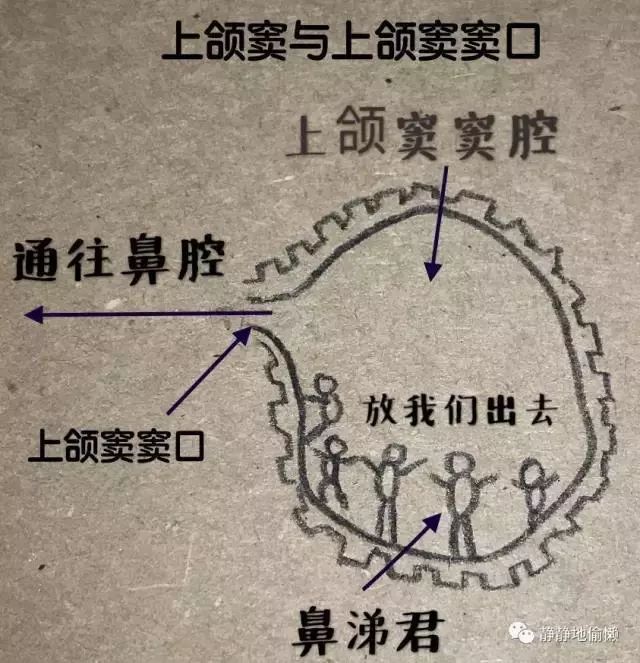 鼻窦积液排出姿势图片