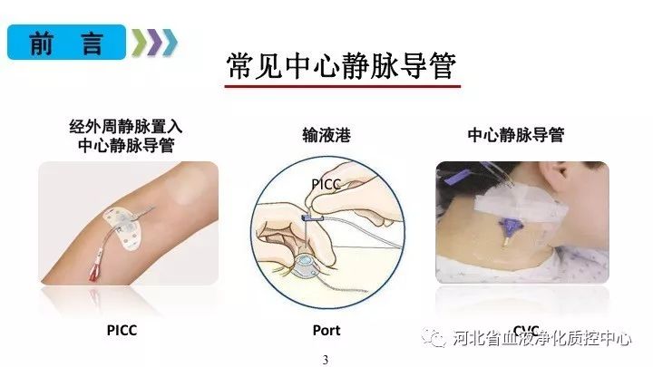 导管的正确姿势图片图片