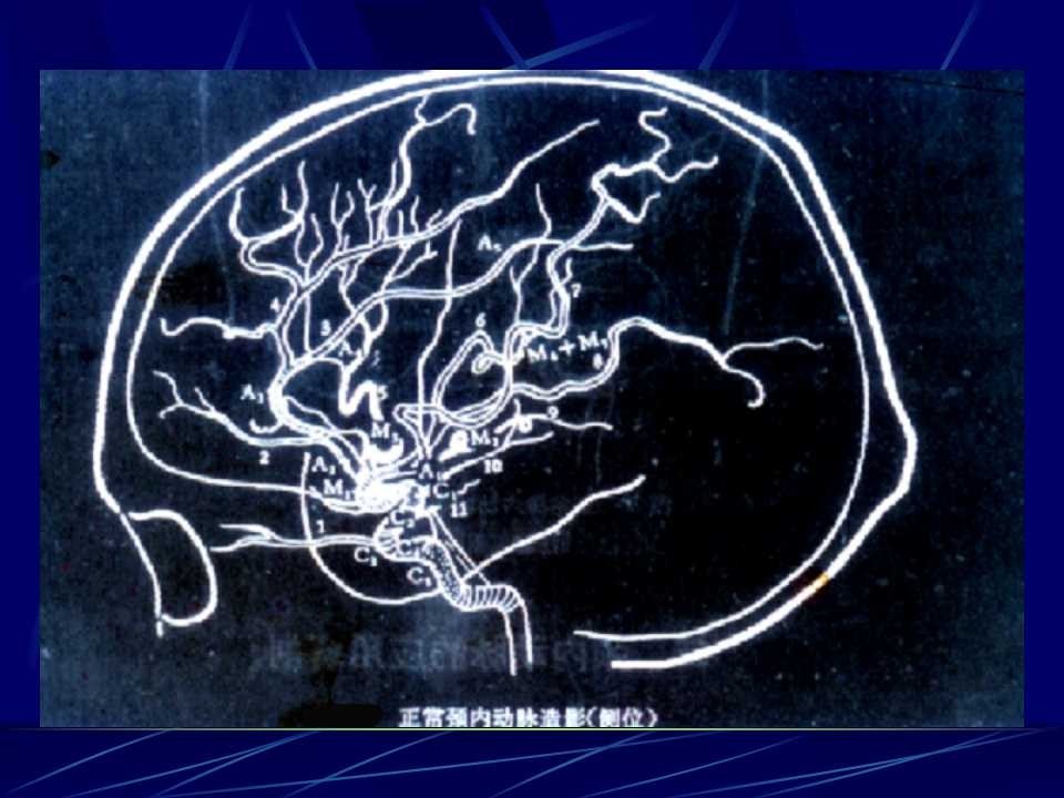 圖解丨腦血管應用解剖