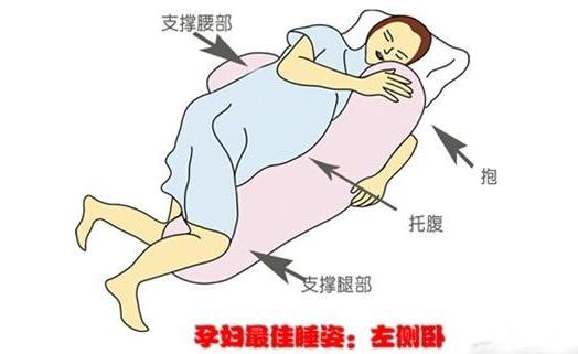 胎盘低置的卧床姿势图片