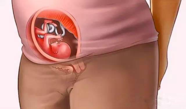 怀孕器官位置挤压图图片