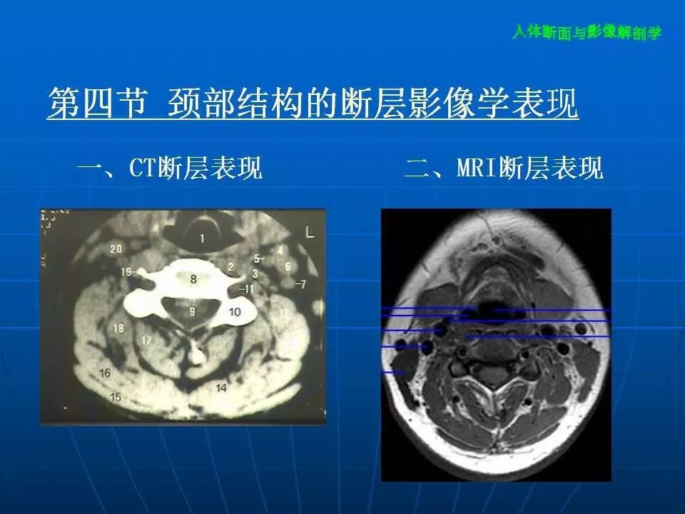 頸部斷面與影像解剖