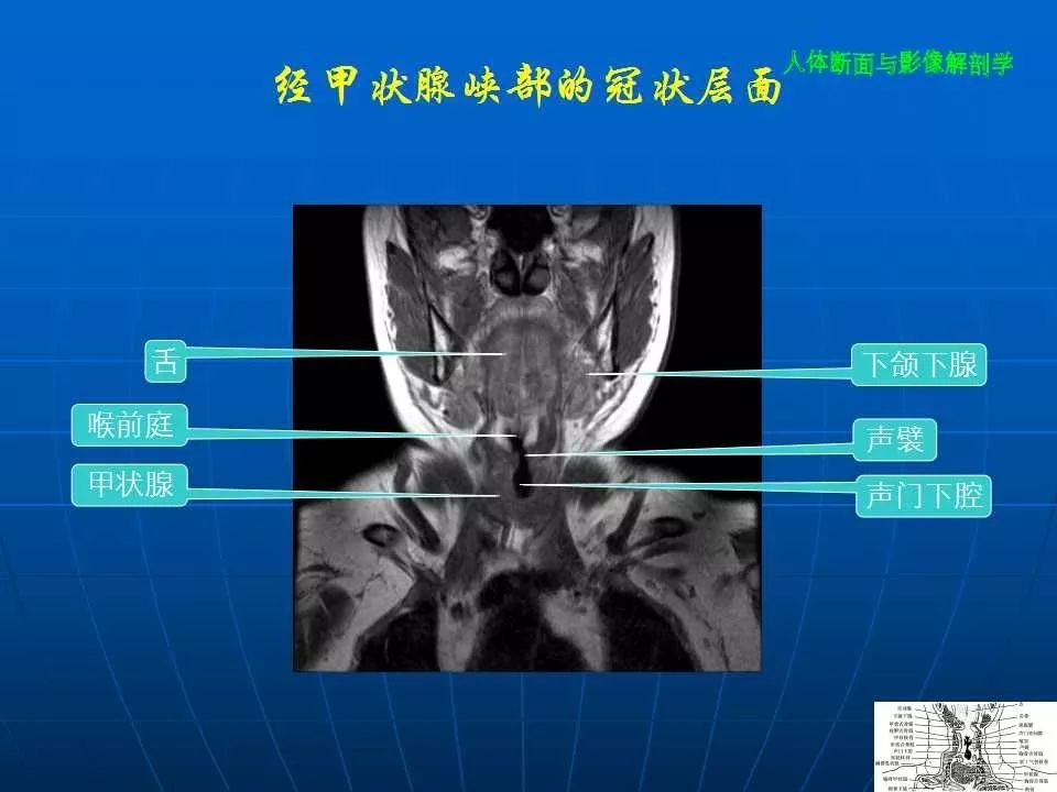 頸部斷面與影像解剖