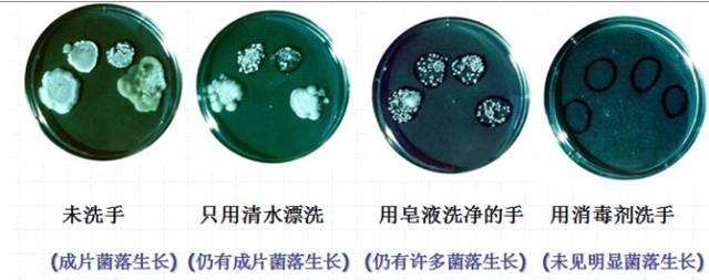洗手前后细菌对比图片