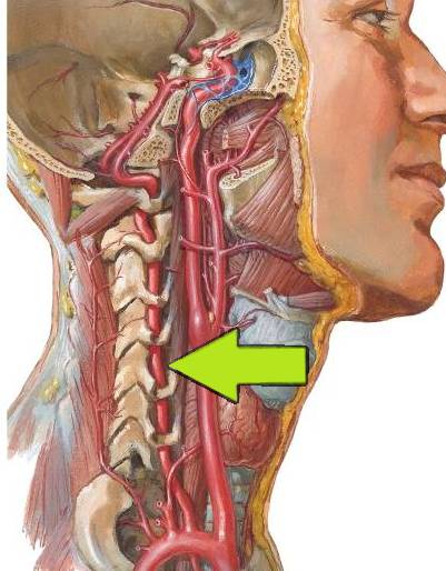 椎动脉的临床应用解剖