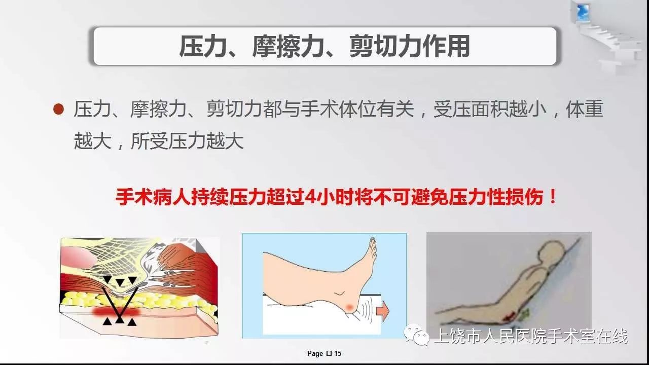 围手术期压力性损伤的防护