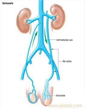 精索静脉曲张为什么常见而且左侧比右侧更多见看了这个就知道原因了