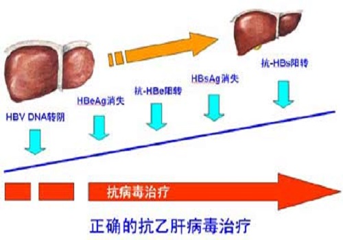 乙肝抗病毒治療的最佳時機