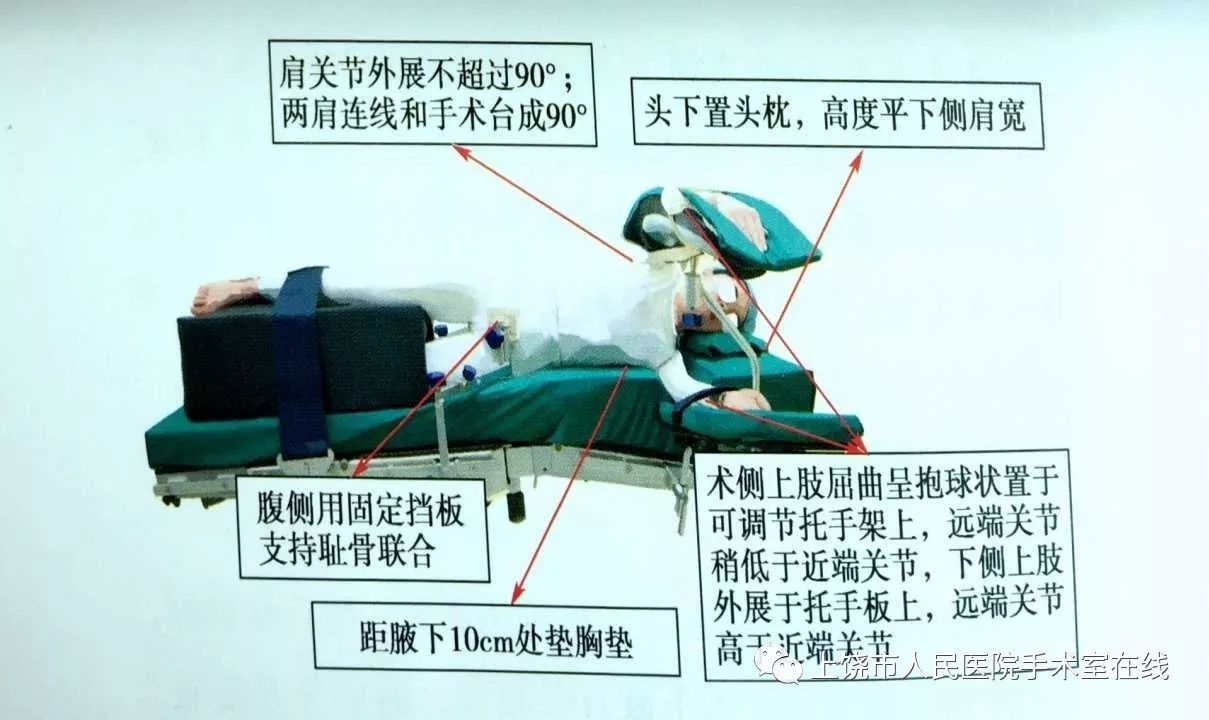 手术折刀位示意图图片