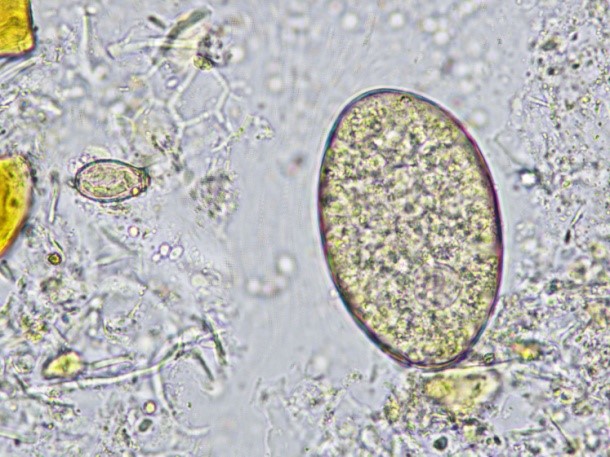 图5:油镜下异形吸虫卵结构图4:油镜下肝吸虫卵(下)和异形吸虫卵(上)图